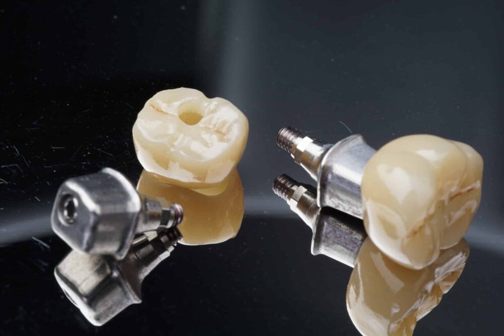 crowns and implants dentistry